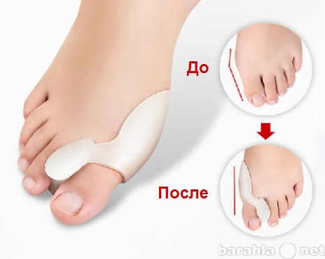 Предложение: Valgus Pro